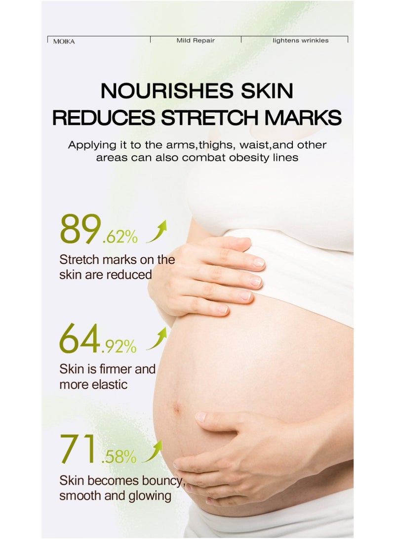 MOIKA Stretchmarks Cream Maternity Skin Treatment Pregnancy Scars Repair, Can Promote Cell Regeneration, Repair Necrotic Cells and Enhance Skin Elasticity, Designed For Mother's Stretch Marks - Image 5